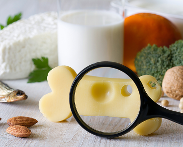 Osteoporose-Diagnostik und -Behandlung